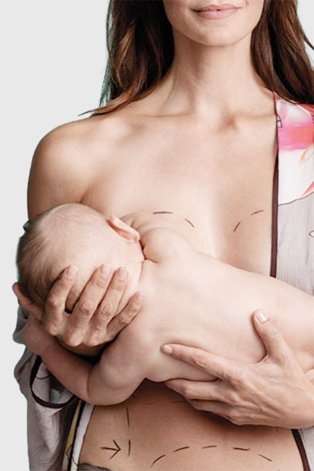 Mommy MakeOver (Annelik Estetiği)